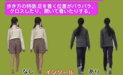 足痛にインソール