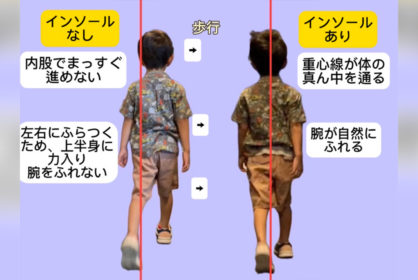 キッズのインソール