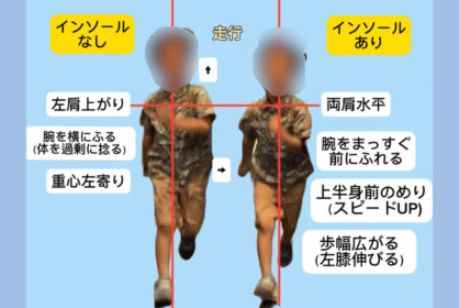 キッズのインソール