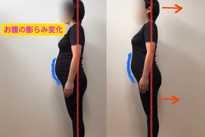 妊娠中の腰痛にインソール