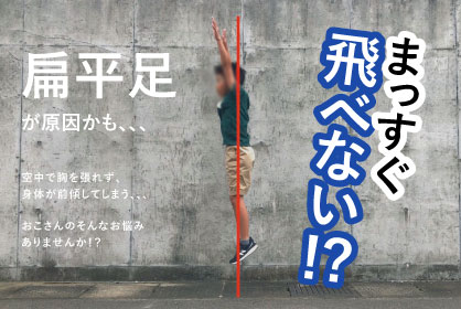 扁平足にインソール